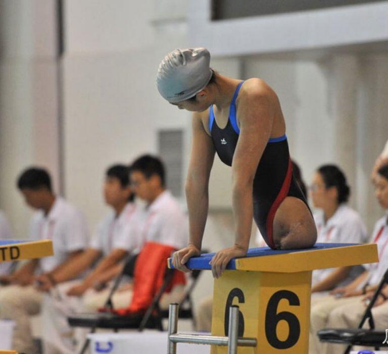 Bé gái 4 tuổi bị tai nạn gây xót xa toàn thế giới, diện mạo hiện tại xinh chuẩn mỹ nhân - 5