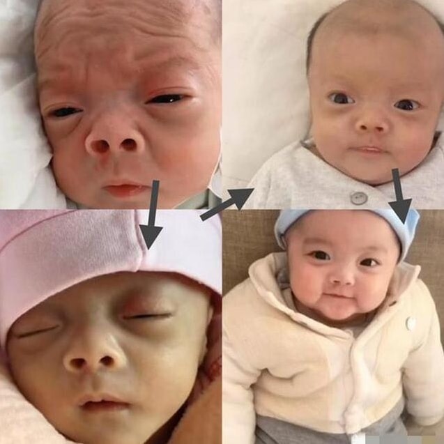 Khi chào đời đứa trẻ được ví như một ông cụ vì vẻ ngoài nhăn nheo, nhưng khi được vài tháng tuổi lập tức dễ thương lạ lùng.