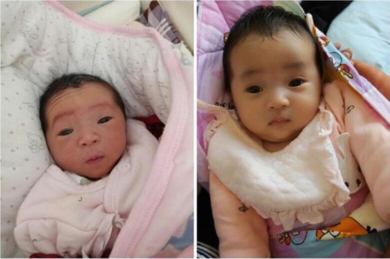 Em bé trong ảnh không thực sự xinh xắn khi mới sinh, với đôi mắt cách xa nhau và những nếp nhăn rõ rệt trên trán. Nhưng khi được ba hoặc bốn tháng tuổi, bé trông hoàn toàn khác.