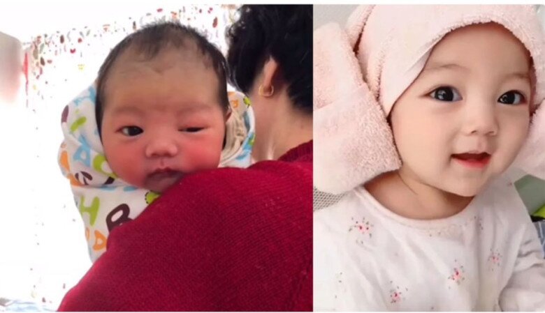 Lúc nhỏ, nhóc tỳ có đôi mắt không cân xứng nhưng mọi thứ đã thay đổi khi được 1 tuổi, thậm chí là cả làn da.