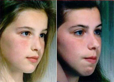 Đứa trẻ lúc nhỏ xinh, càng lớn càng kém sắc vì thói quen này khi ngủ mà nhiều trẻ em hay mắc phải - 5