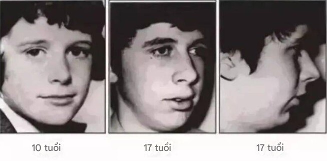 Đứa trẻ lúc nhỏ xinh, càng lớn càng kém sắc vì thói quen này khi ngủ mà nhiều trẻ em hay mắc phải - 4