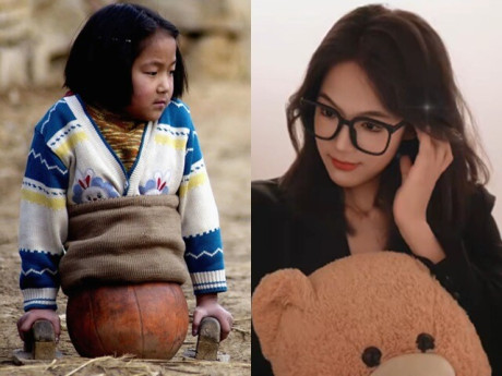 Yêu con - Bé gái 4 tuổi bị tai nạn gây xót xa toàn thế giới, diện mạo hiện tại xinh chuẩn mỹ nhân