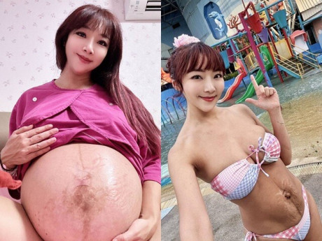 Bà bầu - Hoa hậu bikini đẹp nhất thế giới 5 năm sinh 4 con, bị chê bụng quá xấu, sau PTTM ai nhìn cũng câm nín