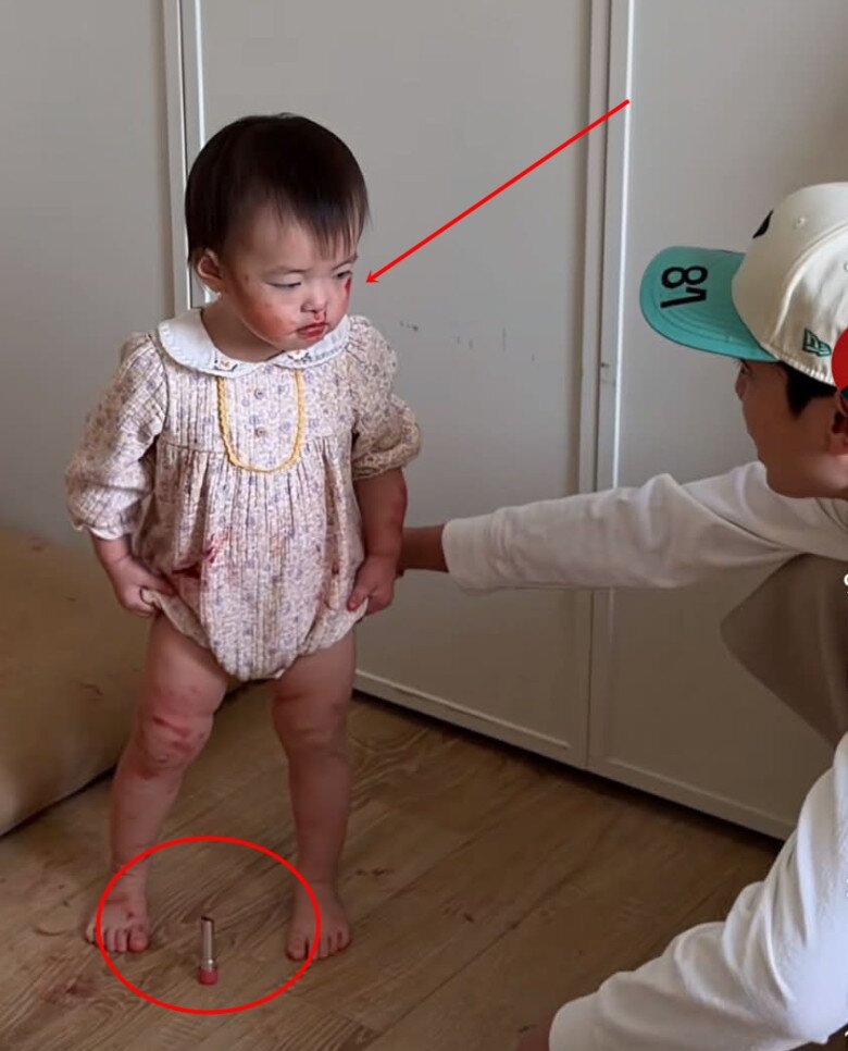 Hốt hoảng khi 2 con gái mặt mũi, chân tay đỏ choe choét, biết lý do, mẹ Việt tức giận - 2