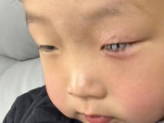 Yêu con - Con bị keo 502 bắn vào mắt, bố nhẹ nhàng đổ thêm một thứ, bác sĩ khen: Hiếm có người thông minh như anh!