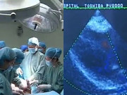 Mang thai 8 tháng, mẹ bầu nhập viện sinh mổ nhưng bác sĩ không thấy thai nhi đâu, lý do khiến nhiều người sợ hãi