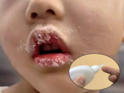 Yêu con - Tưởng keo 502 là son, bé gái bôi lên môi liền bị dính chặt, mẹ tưới thêm 1 thứ được BS khen: Thông minh quá!