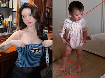 Yêu con - Hốt hoảng khi 2 con gái mặt mũi, chân tay đỏ choe choét, biết lý do, mẹ Việt tức giận