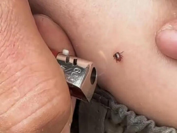 Yêu con - Con gái bị sinh vật lạ cắn vào cổ, bố 2 lần muốn cứu nhưng mẹ từ chối, bác sĩ khen: Mẹ đúng!