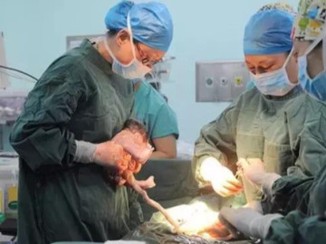 Bà bầu - Đang đỡ đẻ cho sản phụ, bác sĩ bỗng hô lên: "Bố nhanh chụp ảnh! Con anh là một phép màu"