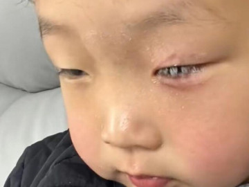 Yêu con - Con bị keo 502 bắn vào mắt, bố nhẹ nhàng đổ thêm một thứ, bác sĩ khen: Hiếm có người thông minh như anh!