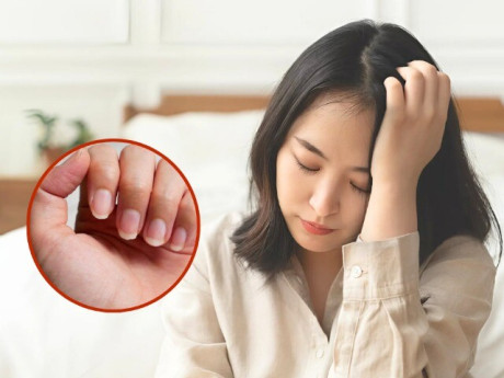 Sức khỏe - Màu sắc móng tay tiết lộ gì về sức khỏe của bạn? Kiểm tra ngay để biết được tình hình của bản thân