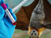 Sức khỏe - Bộ Y tế hướng dẫn chẩn đoán và điều trị bệnh truyền nhiễm do virus Nipah