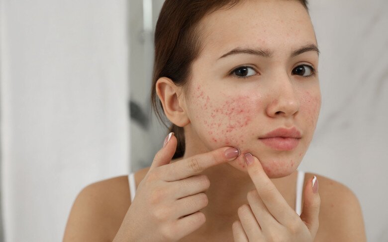 Trong những đợt ô nhiễm không khí ở mức rất xấu, số người đến khám da liễu gia tăng vì làn da bị ảnh hưởng. Ảnh minh họa. 