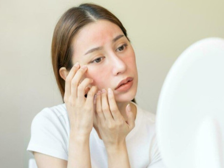 Ngứa râm ran ngoài da tưởng do thời tiết lạnh, không ngờ lại trở thành “cơn ác mộng” với cô gái trẻ ở Hà Nội