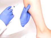 Sức khỏe - Gọi dịch vụ để tiêm nắn thẳng chân tại nhà, cô gái 29 tuổi phải nhập viện vì hai chân biến dạng