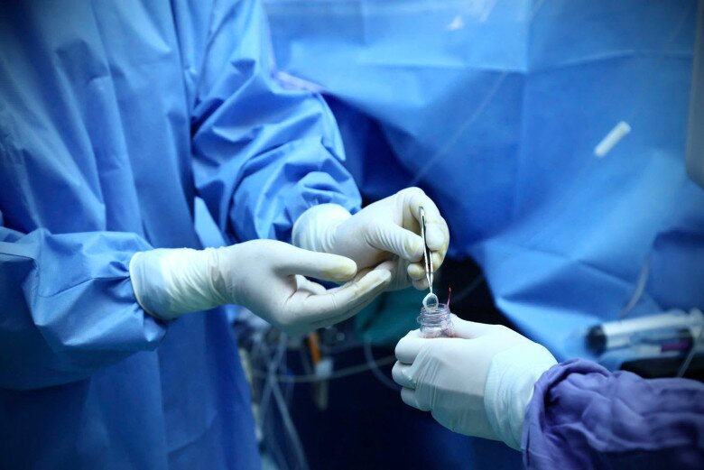 Các bác sĩ đang thực hiện lấy giác mạc để điều phối vào BV Trung ương Huế giúp người bệnh tìm lại được ánh sáng cuộc đời. Ảnh: BVCC.