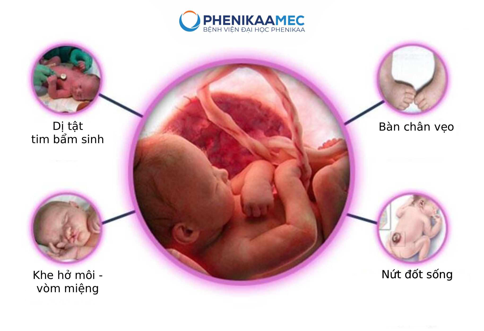 Dị tật bẩm sinh hoàn toàn có thể phát hiện thông qua thăm khám thai định kỳ