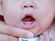 Dấu hiệu mọc răng và cách chăm sóc răng mới nhú
