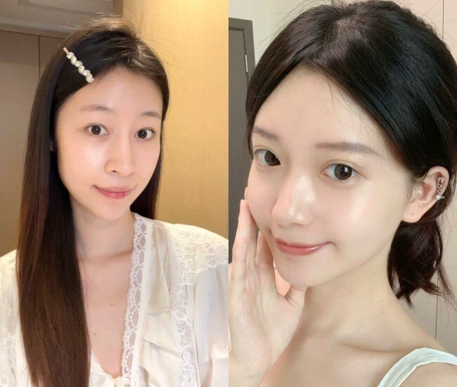 PDRN chiết xuất từ tinh trùng cá hồi giúp kích thích tái tạo tế bào, tăng sinh collagen, cải thiện độ đàn hồi và phục hồi da tổn thương, mang lại làn da căng mịn, khỏe khoắn tự nhiên.