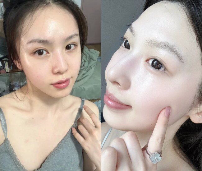 Axit azelaic có khả năng kháng viêm, giảm mụn, ức chế melanin, làm sáng da và cải thiện tăng sắc tố, phù hợp nhiều loại da nhờ đặc tính dịu nhẹ, ít kích ứng.