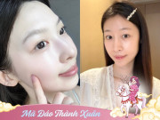 Đẹp - 3 phương pháp làm đẹp hứa hẹn "làm mưa làm gió" năm 2026, chị em áp dụng là trẻ hoá diện mạo hơn hẳn