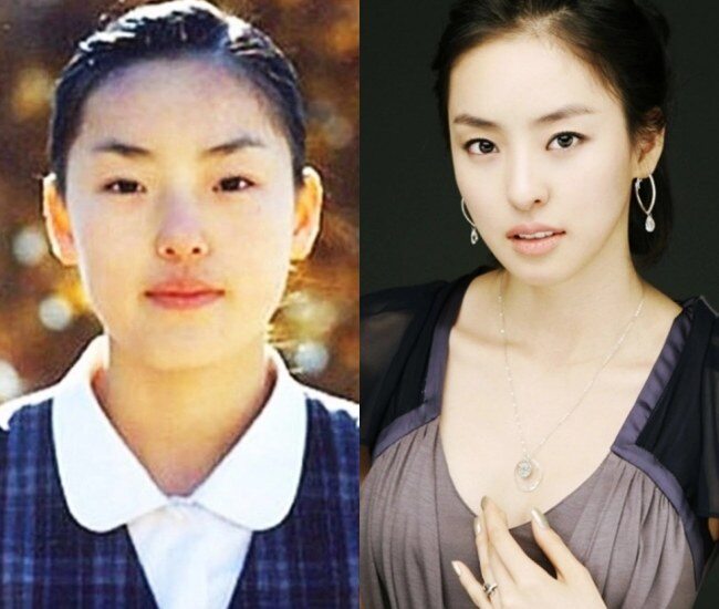 Nhan sắc của Lee Da Hee trước khi dao kéo.