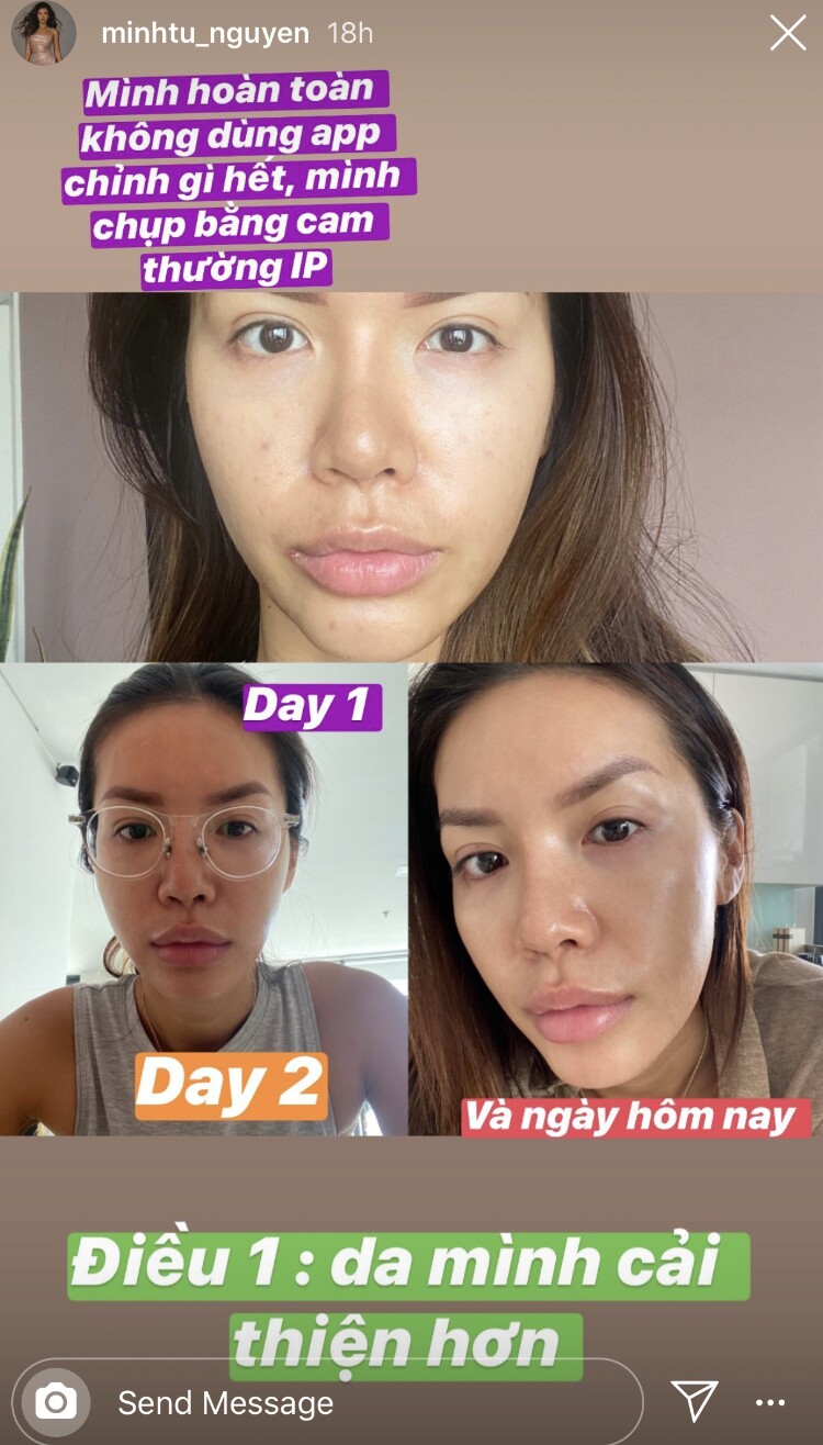 Làn da căng bóng, đều màu hơn của Siêu mẫu Minh Tú sau 3 ngày uống nước ép.