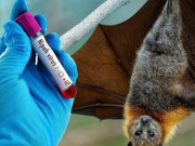 Sức khỏe - Virus Nipah: Cảnh giác đúng mức, không hoang mang trước nguy cơ xâm nhập