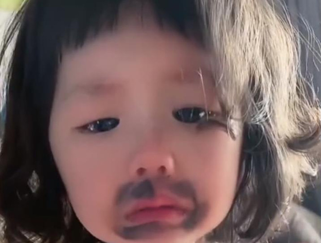 Bé gái 4 tuổi ngủ dậy khóc thét vì miệng “mọc” đầy vết đen lạ, nguyên nhân từ món ăn yêu thích mỗi ngày - 2