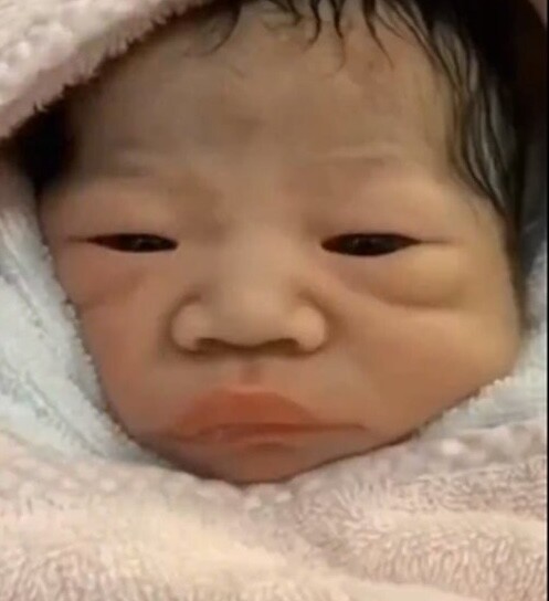 Bé gái chào đời bị họ hàng chê xấu dù bố mẹ đẹp, vài tháng sau lột xác nhận không ra - 1
