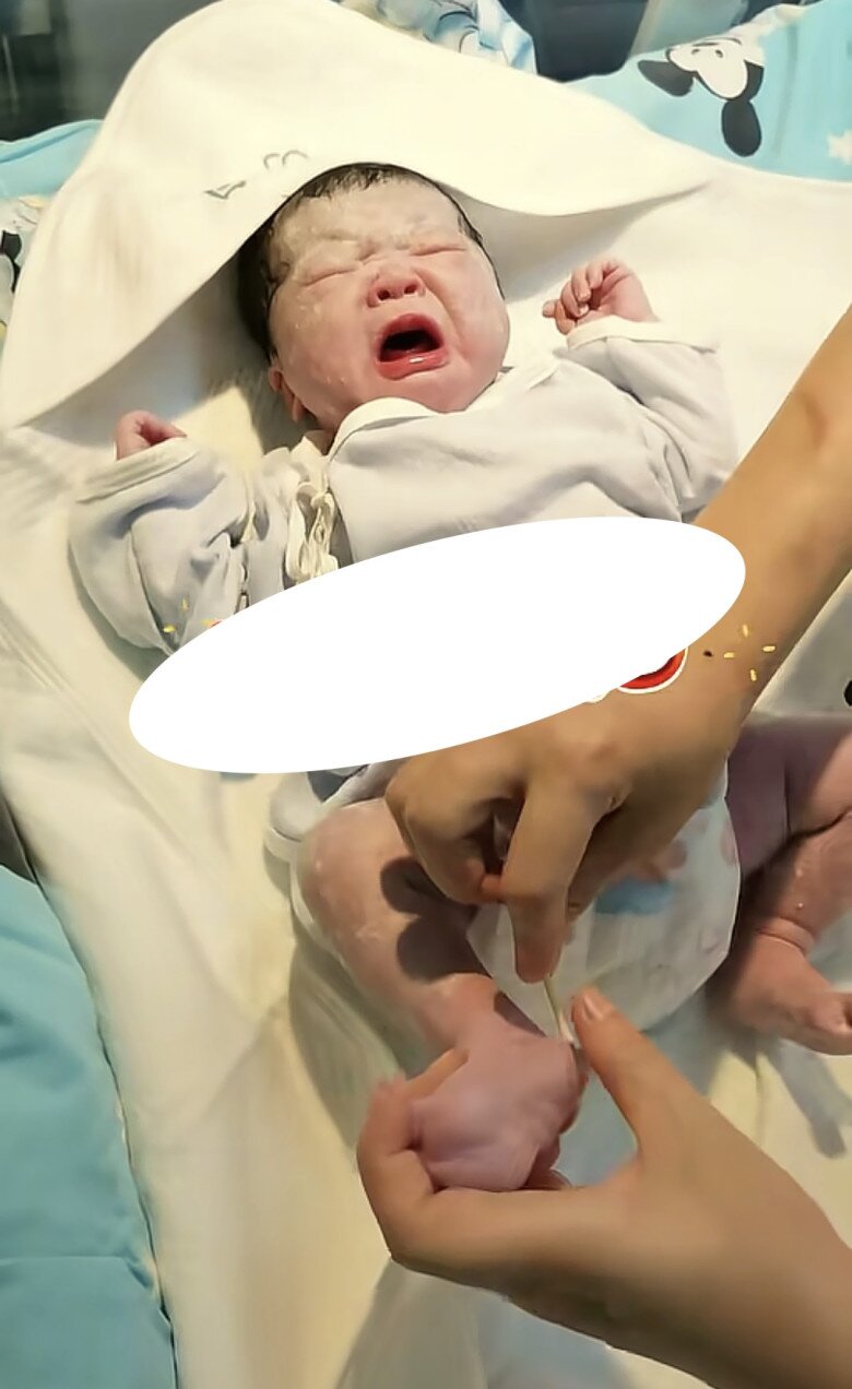 Bé sơ sinh chào đời bị bác sĩ và y tá liên tục tác động ngay trên bàn mổ, người mẹ rối rít cảm ơn - 3