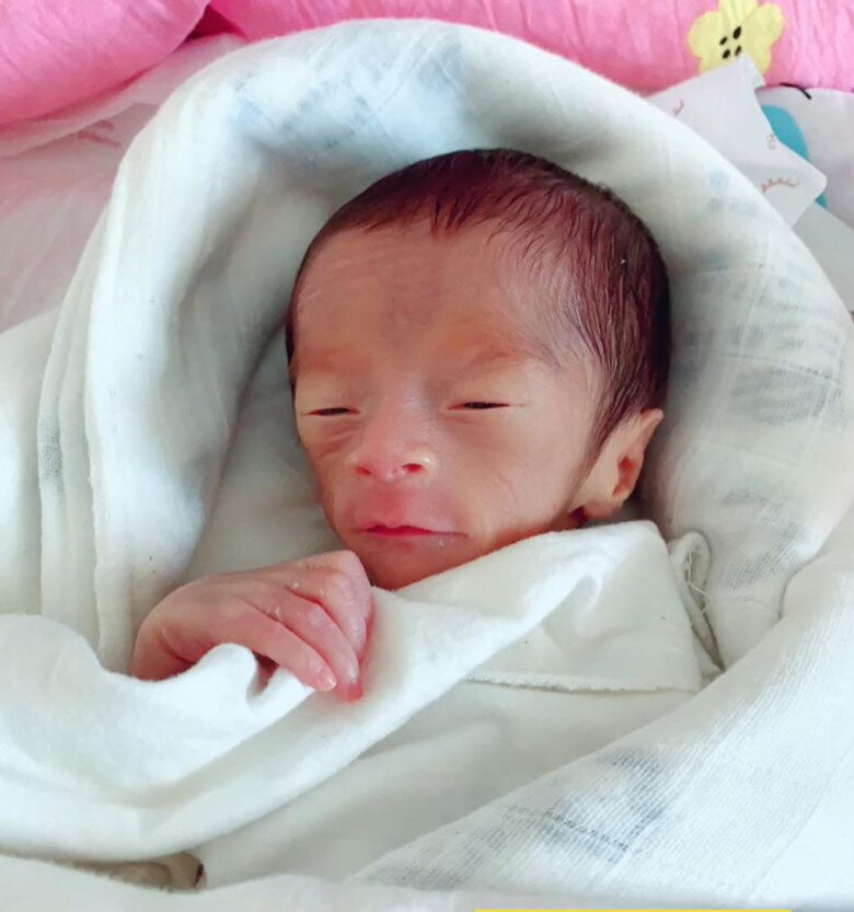 Lúc mới sinh đứa trẻ trông như ông cụ.