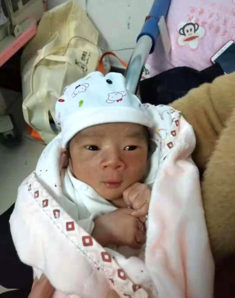 Bé sơ sinh chào đời da nhăn nheo như “khỉ con”, nửa năm sau bố mẹ kinh ngạc không nhận ra đứa trẻ ngày nào - 2