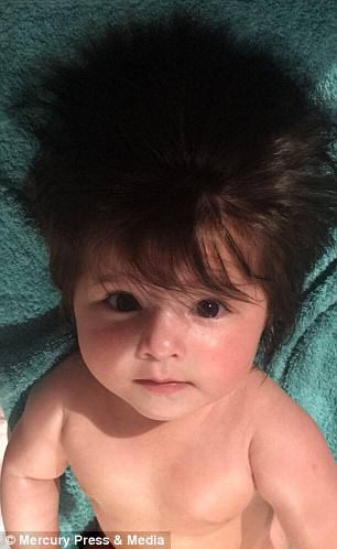 Đến viện siêu âm, mẹ bầu giật mình thấy điểm lạ trên đầu con, cái kết bé gái sinh ra đã nổi tiếng vì quá xinh - 3