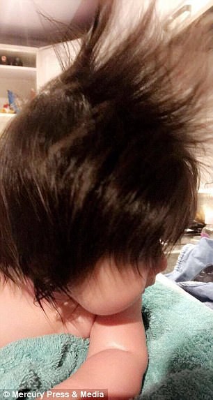 Đến viện siêu âm, mẹ bầu giật mình thấy điểm lạ trên đầu con, cái kết bé gái sinh ra đã nổi tiếng vì quá xinh - 6