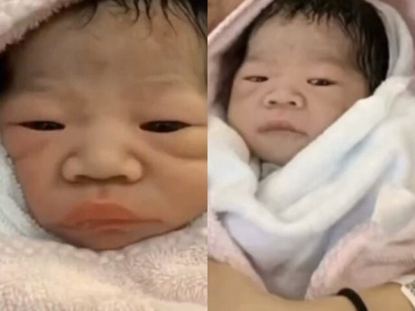 Bé gái chào đời bị họ hàng chê xấu dù bố mẹ đẹp, vài tháng sau lột xác nhận không ra