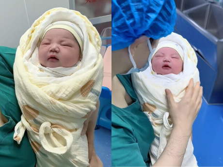 Bé sơ sinh chào đời khiến phòng mổ bệnh viện náo loạn vì như búp bê, bác sĩ ra lệnh liền biết làm theo