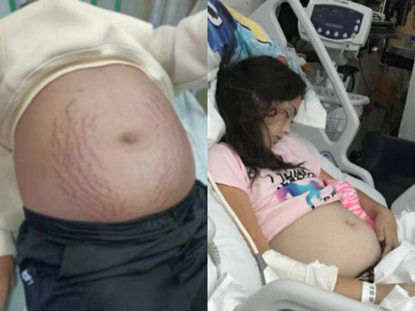 Yêu con - Bé gái lớp 9 bụng phình to như mang bầu, bác sĩ khám cho đứa trẻ nói 3 từ khiến mẹ kinh hãi ngã quỵ
