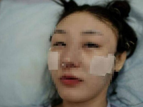 Bà bầu - Phú bà U50 phẫu thuật thẩm mỹ để săn “hồng hài nhi” 19 tuổi, cái kết đắng lòng khi bác sĩ thông báo mang thai