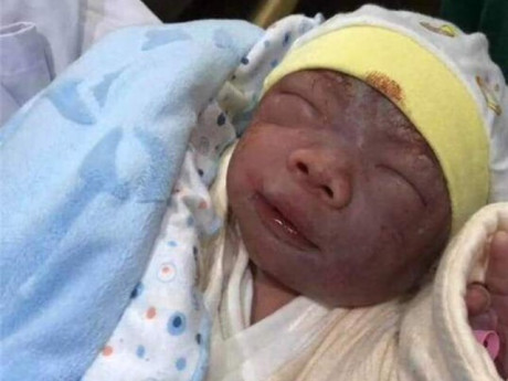 Yêu con - Mẹ muốn khóc khi con sơ sinh chào đời tím tái như “củ khoai môn”, 3 tháng sau “lột xác” xinh như búp bê