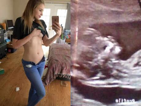 Bà bầu - Nữ sinh chụp bụng bầu 7 tháng phẳng lỳ, láng mịn, ảnh siêu âm đứa trẻ khiến nhiều người hoang mang