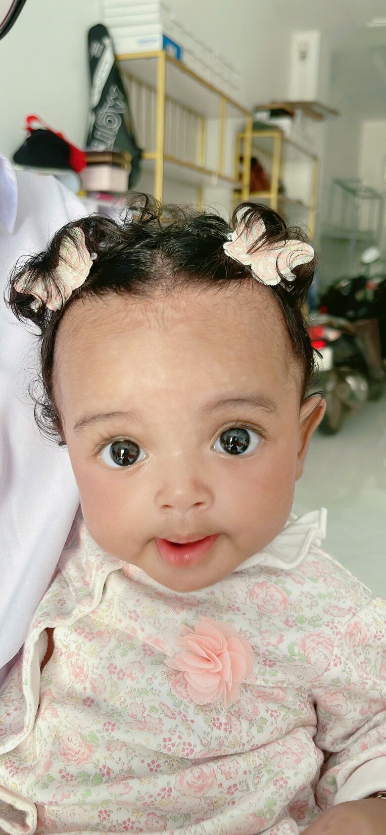 Gái xinh TPHCM đẻ 7 con, có em bé tóc xoăn da đen, diện mạo khác hẳn bố mẹ, bác sĩ thốt lên: Quá đẹp! - 5