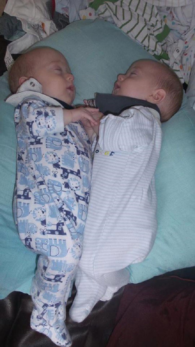 Mẹ bầu mang thai đôi cực đặc biệt, bác sĩ nói đứa trẻ khó sống sót nhưng siêu âm thấy cảnh tượng kỳ diệu - 2