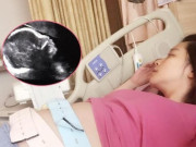 Bà bầu - Mẹ bầu đến bệnh viện khám thai mỗi lần đều cho kết quả khác nhau, tá hoả khi nghe bác sĩ kết luận sinh 4 con