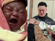 Bà bầu - Bố mẹ hoảng sợ khi con sơ sinh chào đời da nửa đen nửa tím, bác sĩ tức giận: "Anh chị đáng nhận kết quả này"