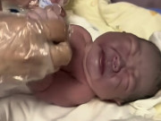 Bà bầu - Bà bầu muốn con trắng trẻo nên ngày nào cũng ăn một thứ, phát hoảng khi đứa trẻ chào đời da tím sẫm, nặng 4kg