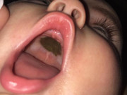 Yêu con - Mẹ phát hoảng thấy miệng con xuất hiện đốm đen lạ, đến bệnh viện nghe bác sĩ chúc mừng mà xấu hổ