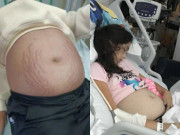 Yêu con - Bé gái lớp 9 bụng phình to như mang bầu, bác sĩ khám cho đứa trẻ nói 3 từ khiến mẹ kinh hãi ngã quỵ